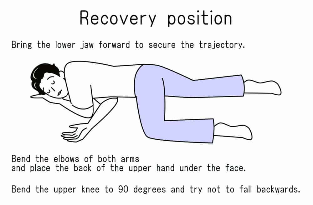 recovery position, medical emergency, alcohol poisoning